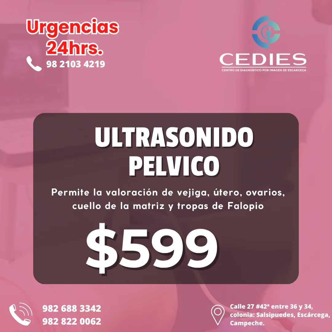 Diseño 45