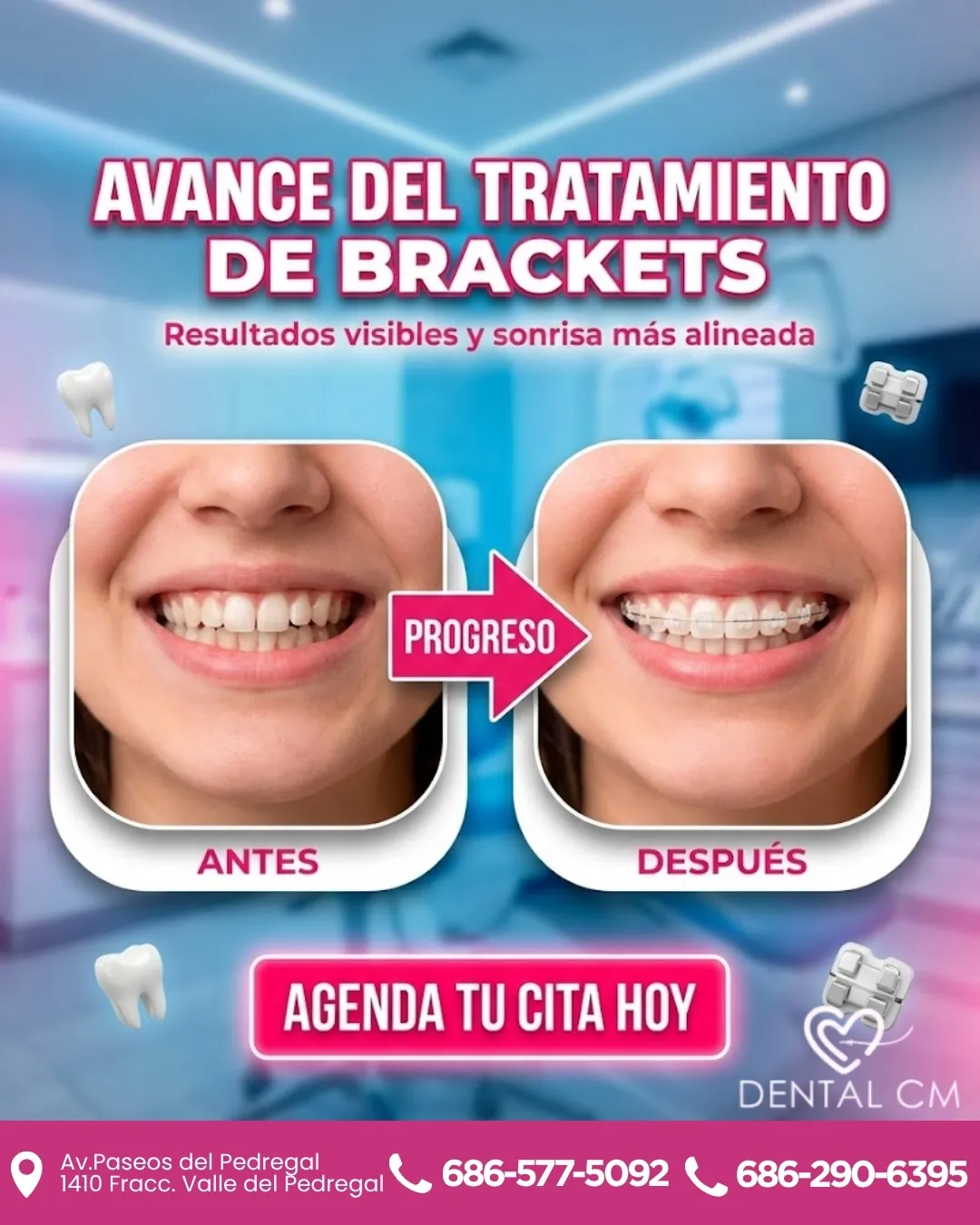 Diseño 40