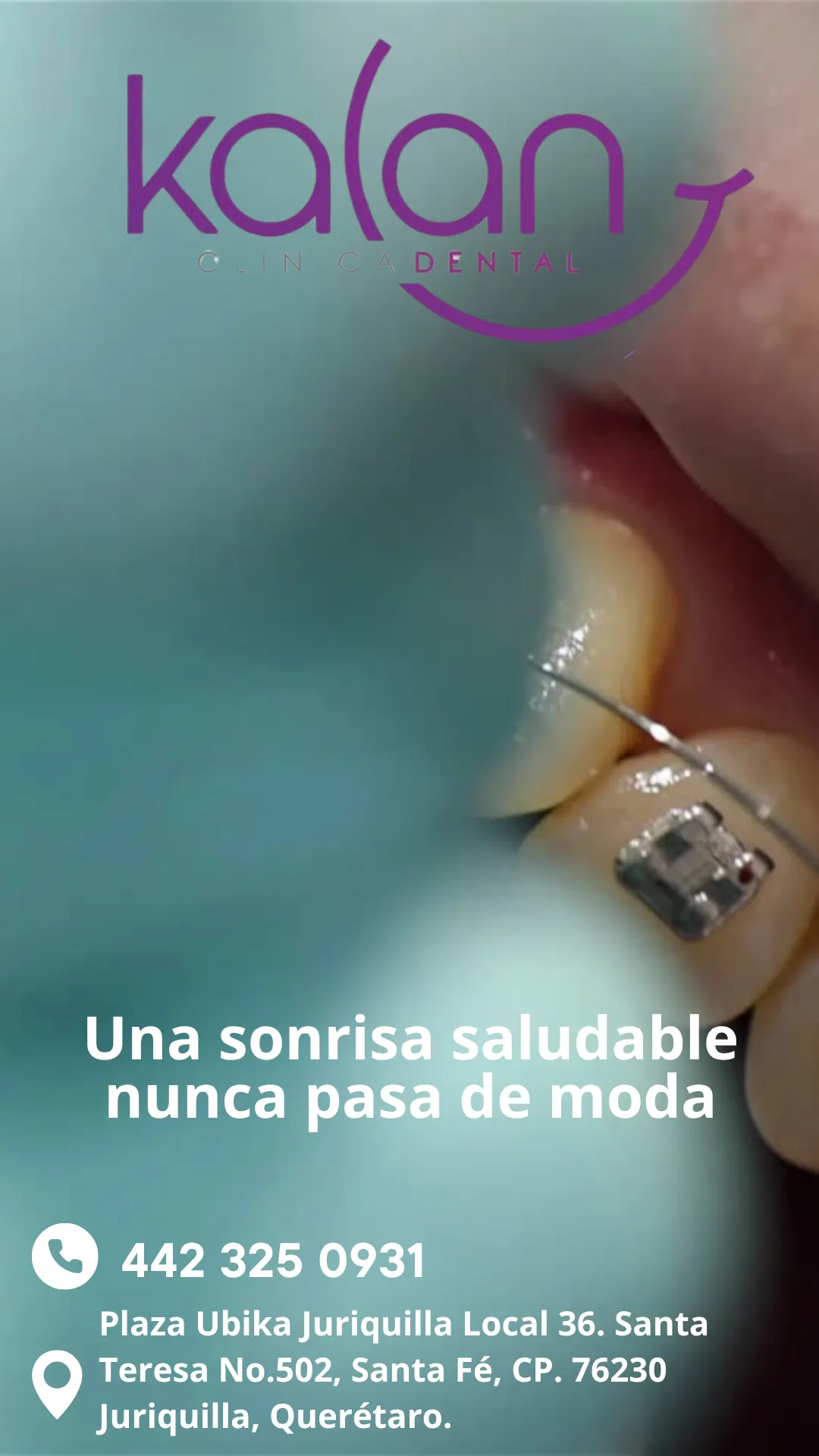 Diseño 56
