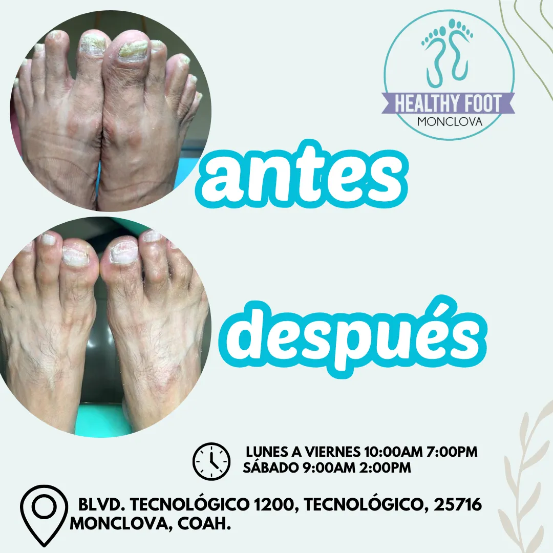 Diseño 22