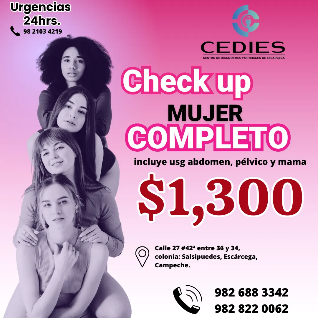 Diseño 102