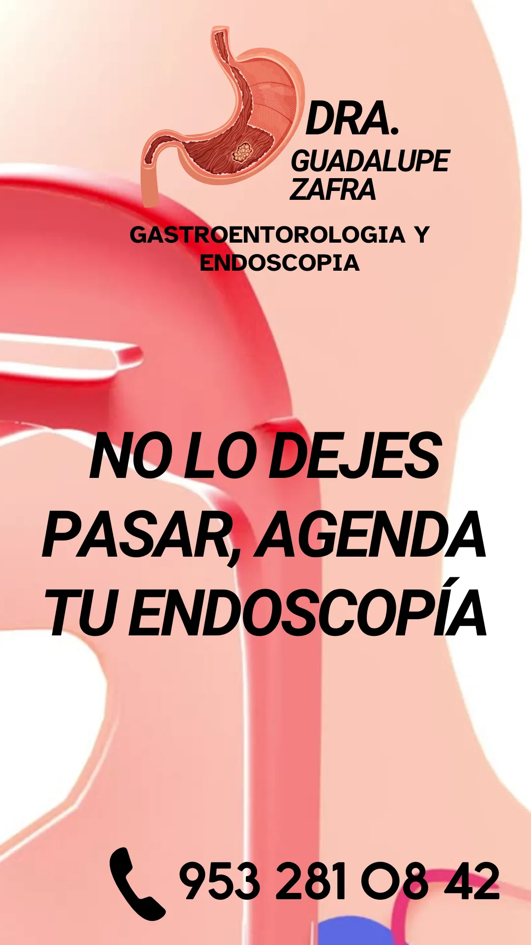 Diseño 30