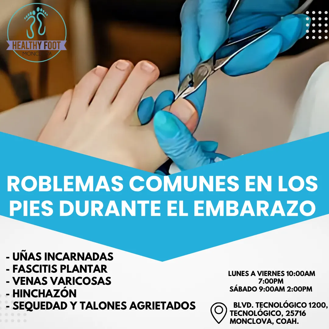 Diseño 56
