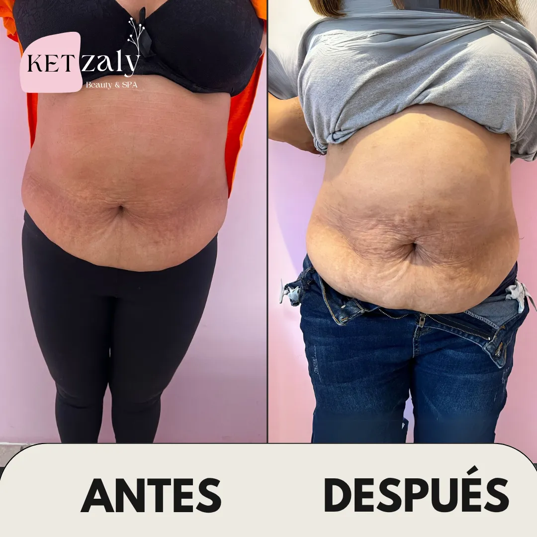 Diseño 23