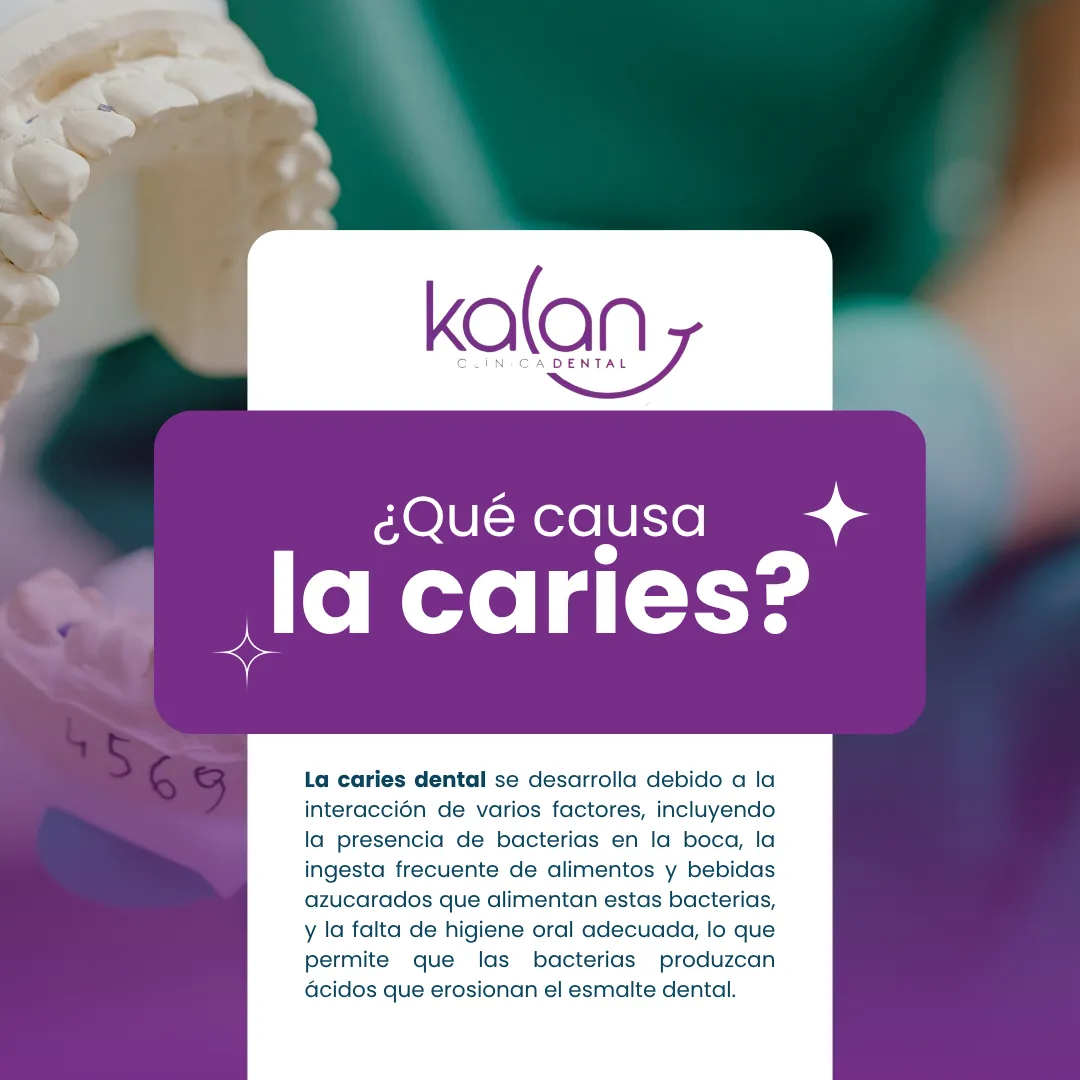 Diseño 59