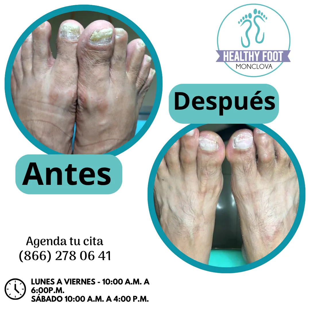 Diseño 15
