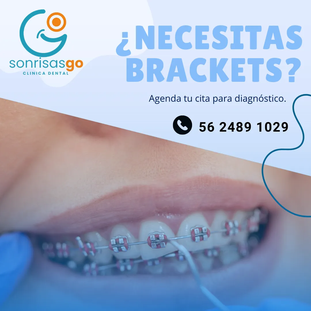 Diseño 91