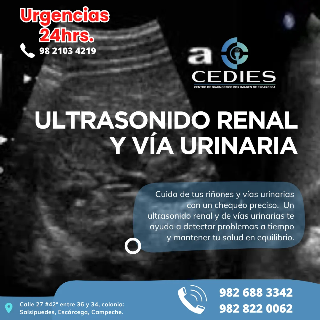 Diseño 30