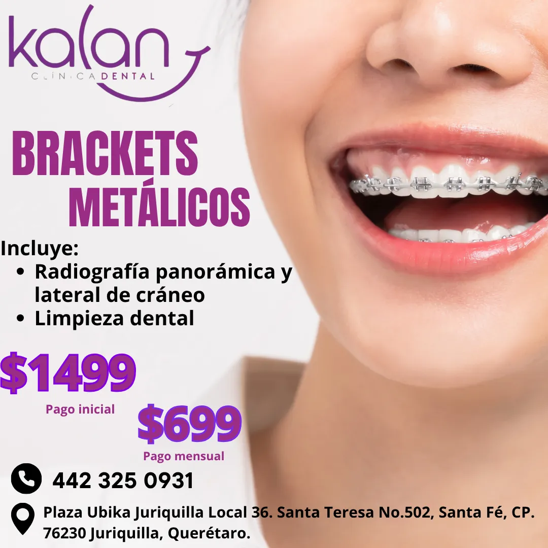 Diseño 44