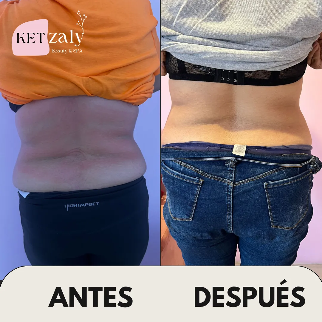 Diseño 20