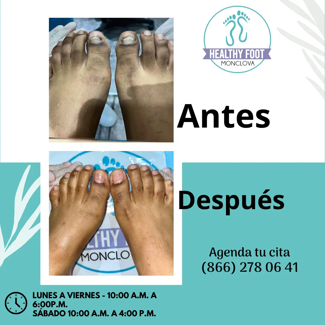 Diseño 12