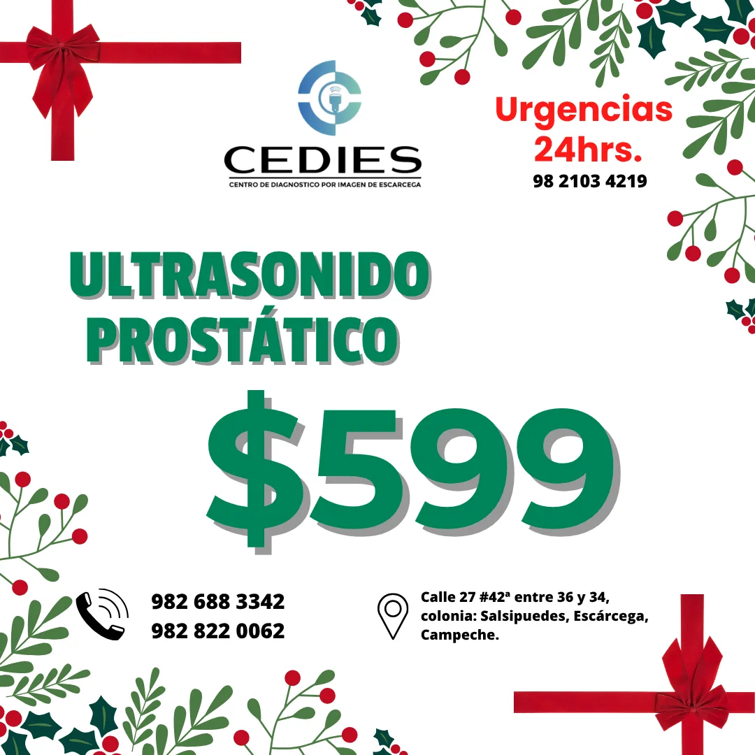Diseño 80