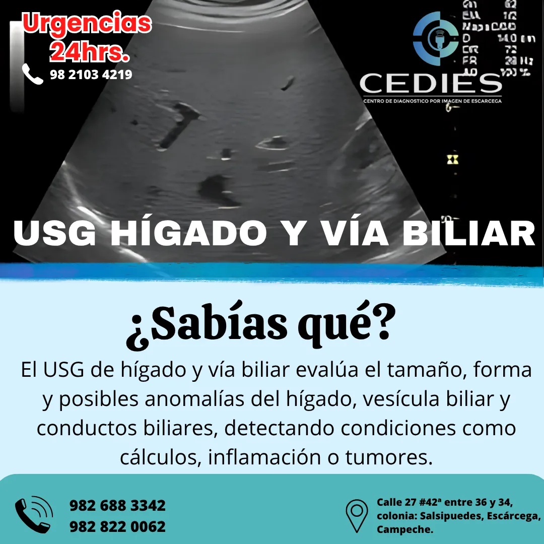 Diseño 72