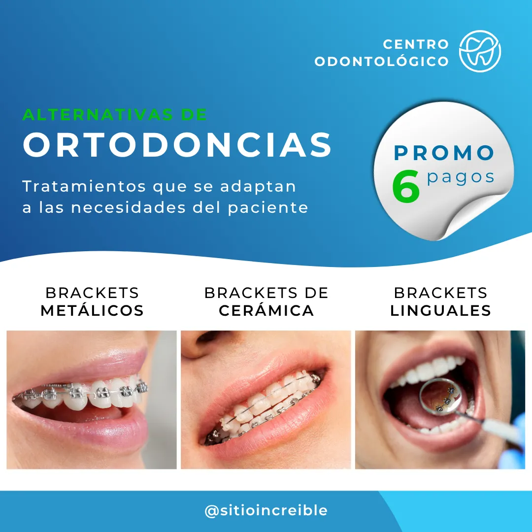 Diseño 45
