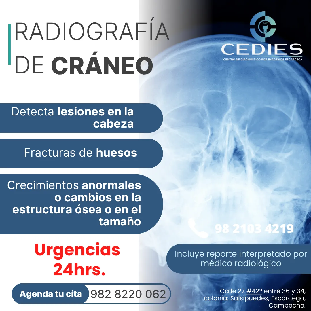 Diseño 3