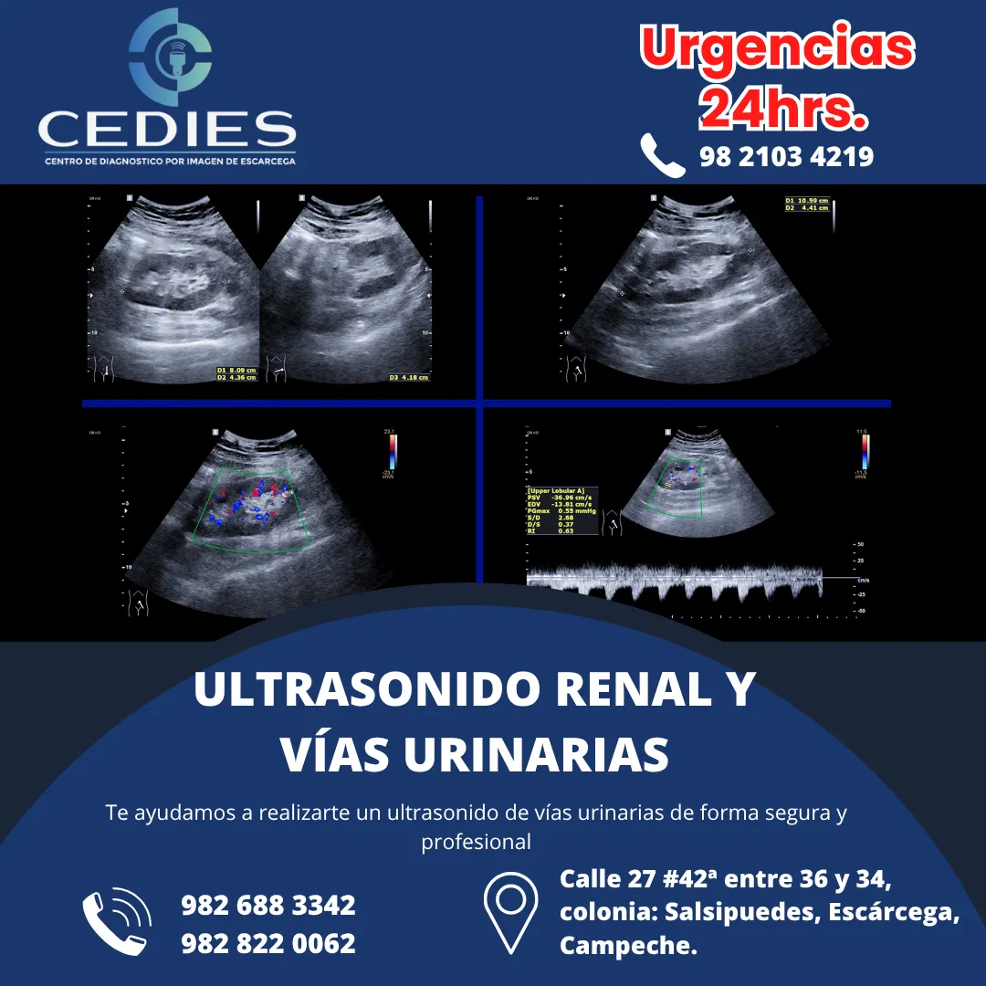 Diseño 11
