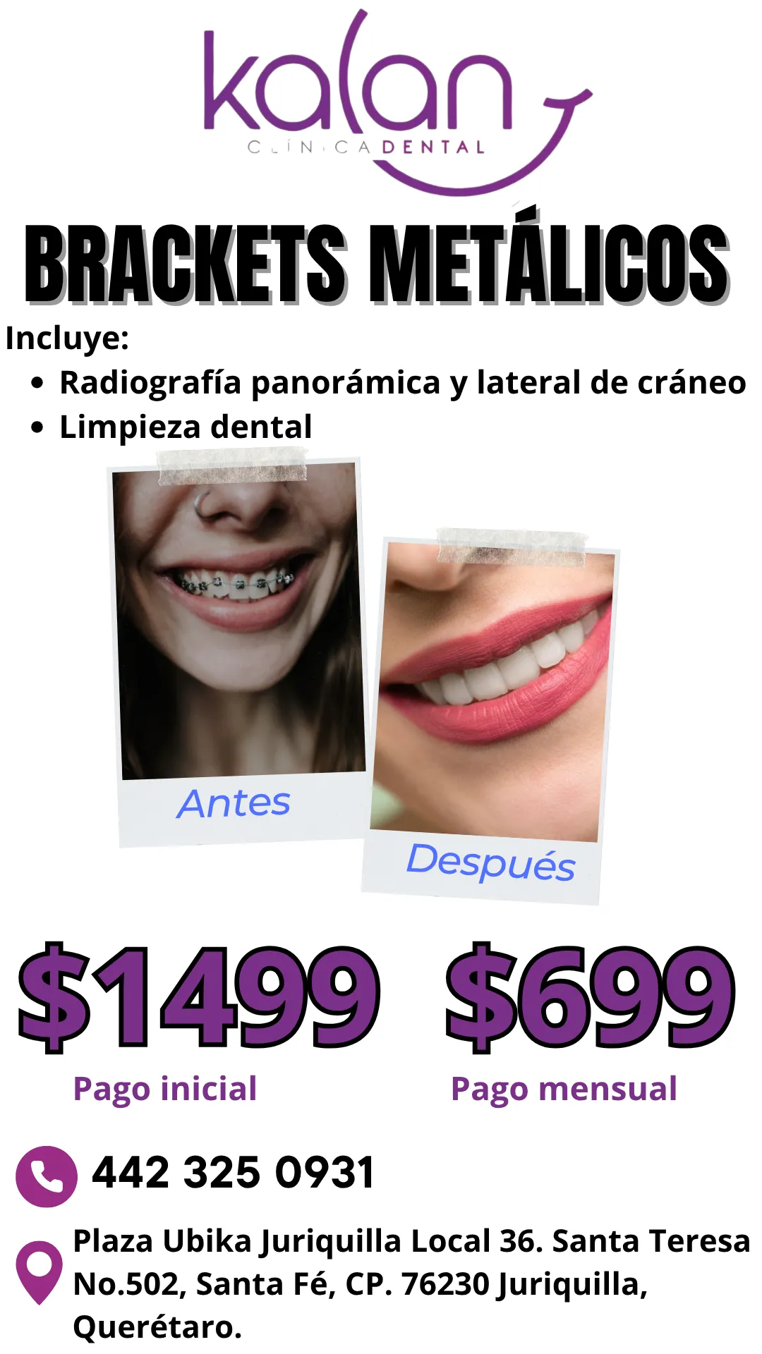 Diseño 92