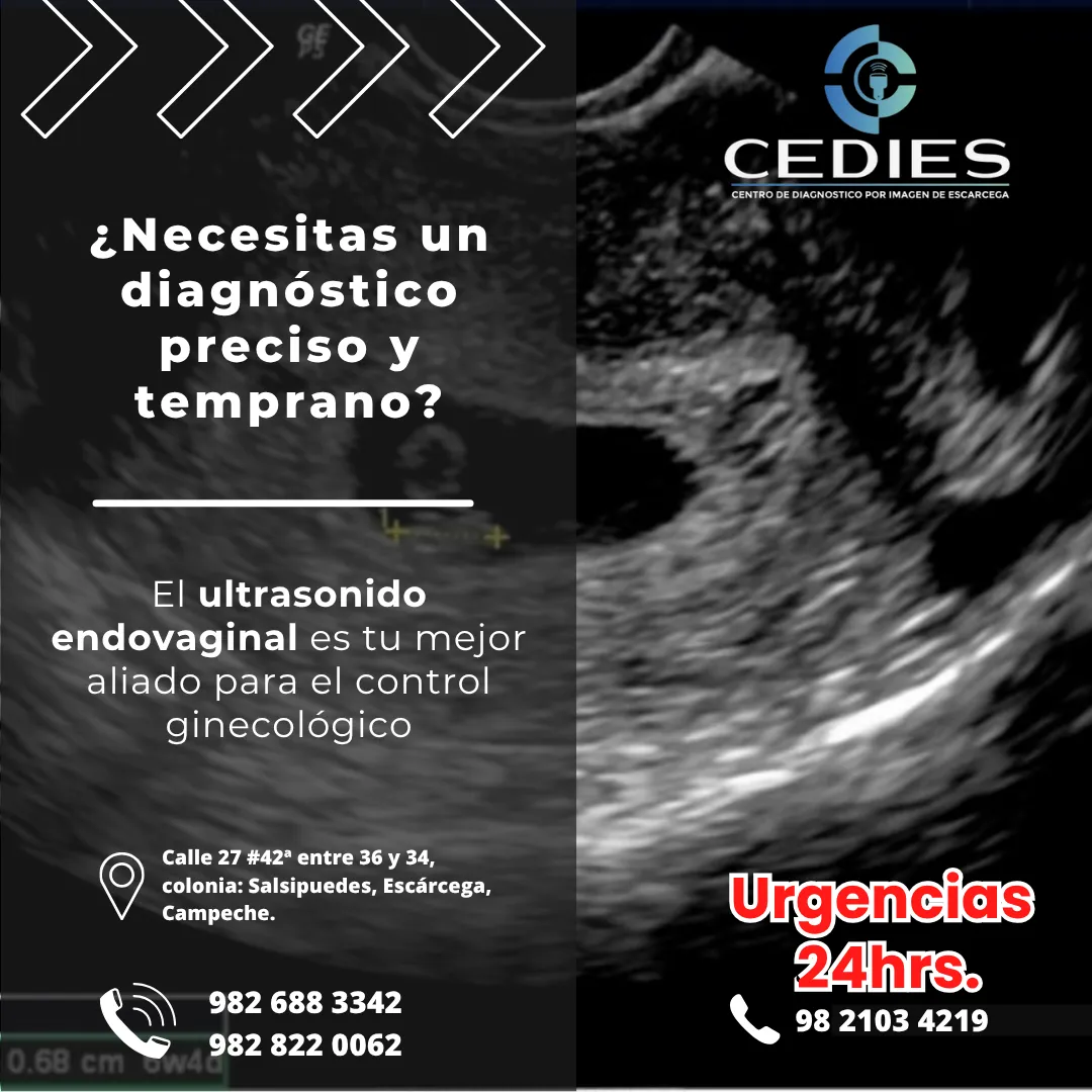 Diseño 13