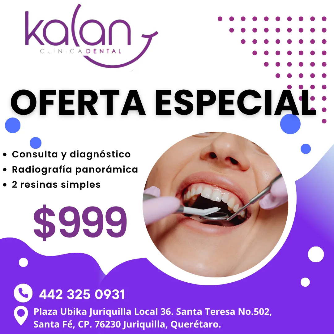 Diseño 80