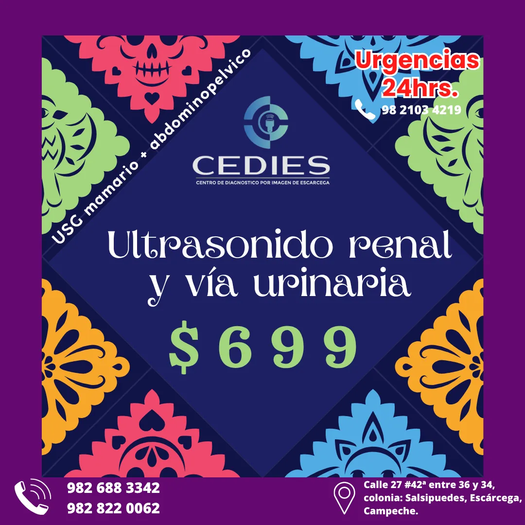 Diseño 54