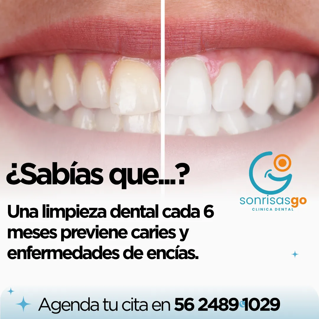 Diseño 49