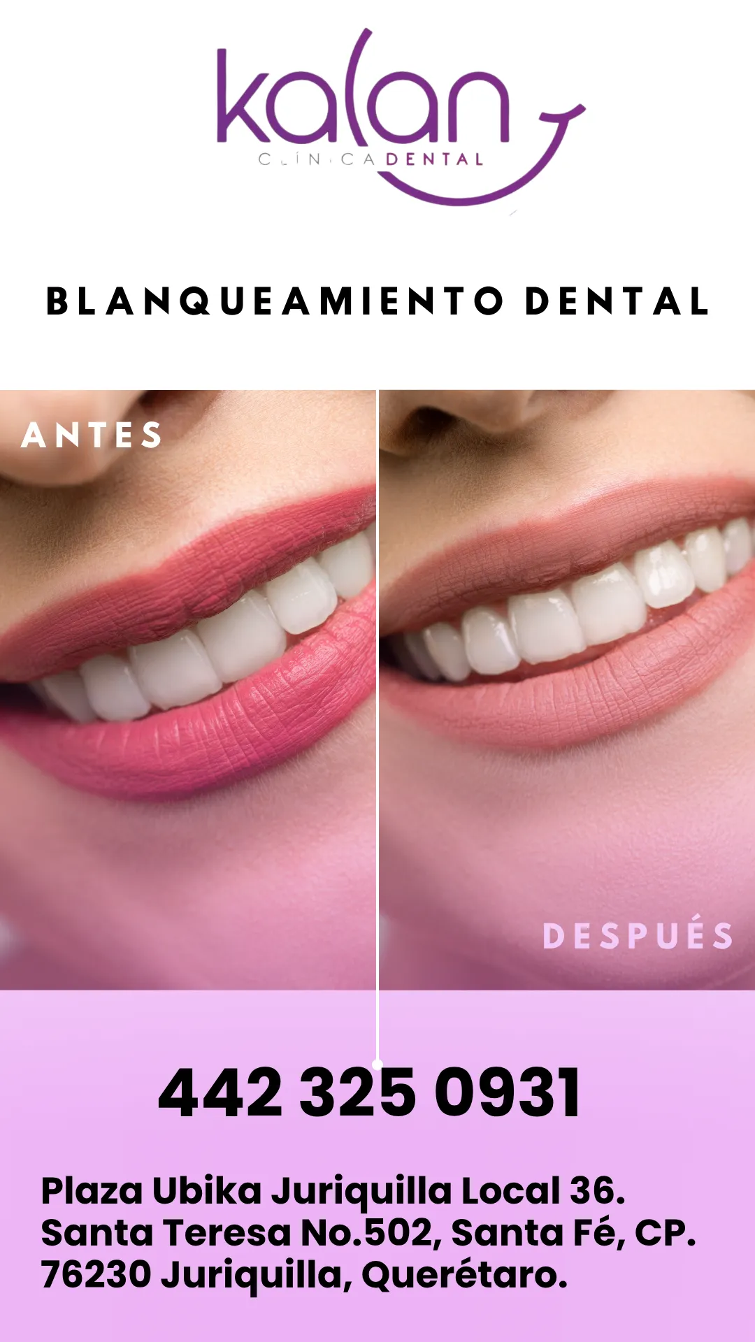 Diseño 43