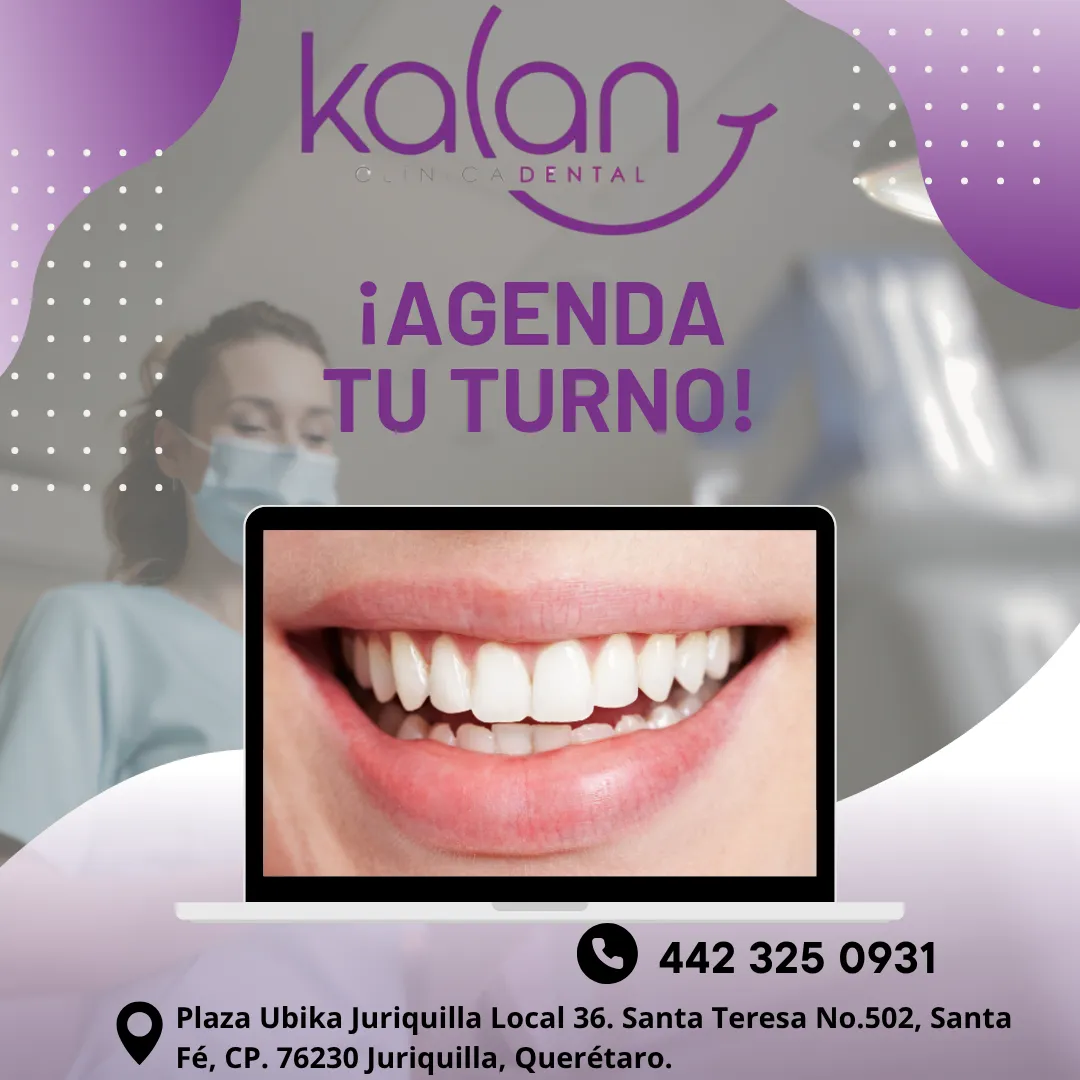 Diseño 123