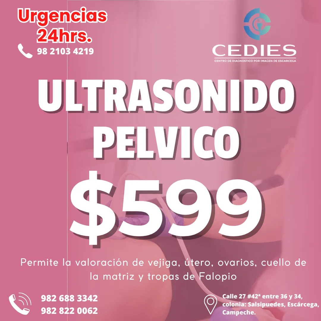 Diseño 40