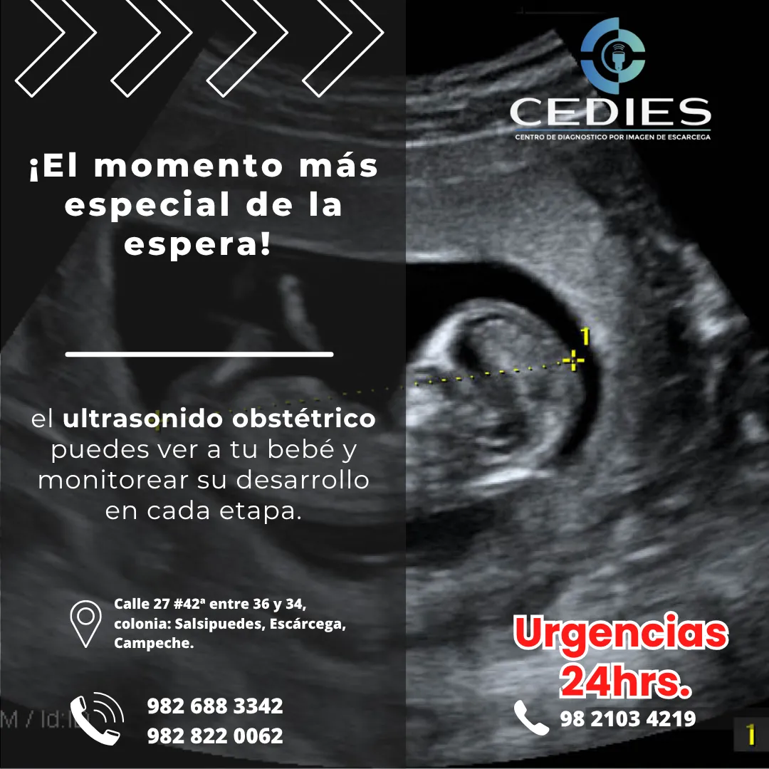 Diseño 16