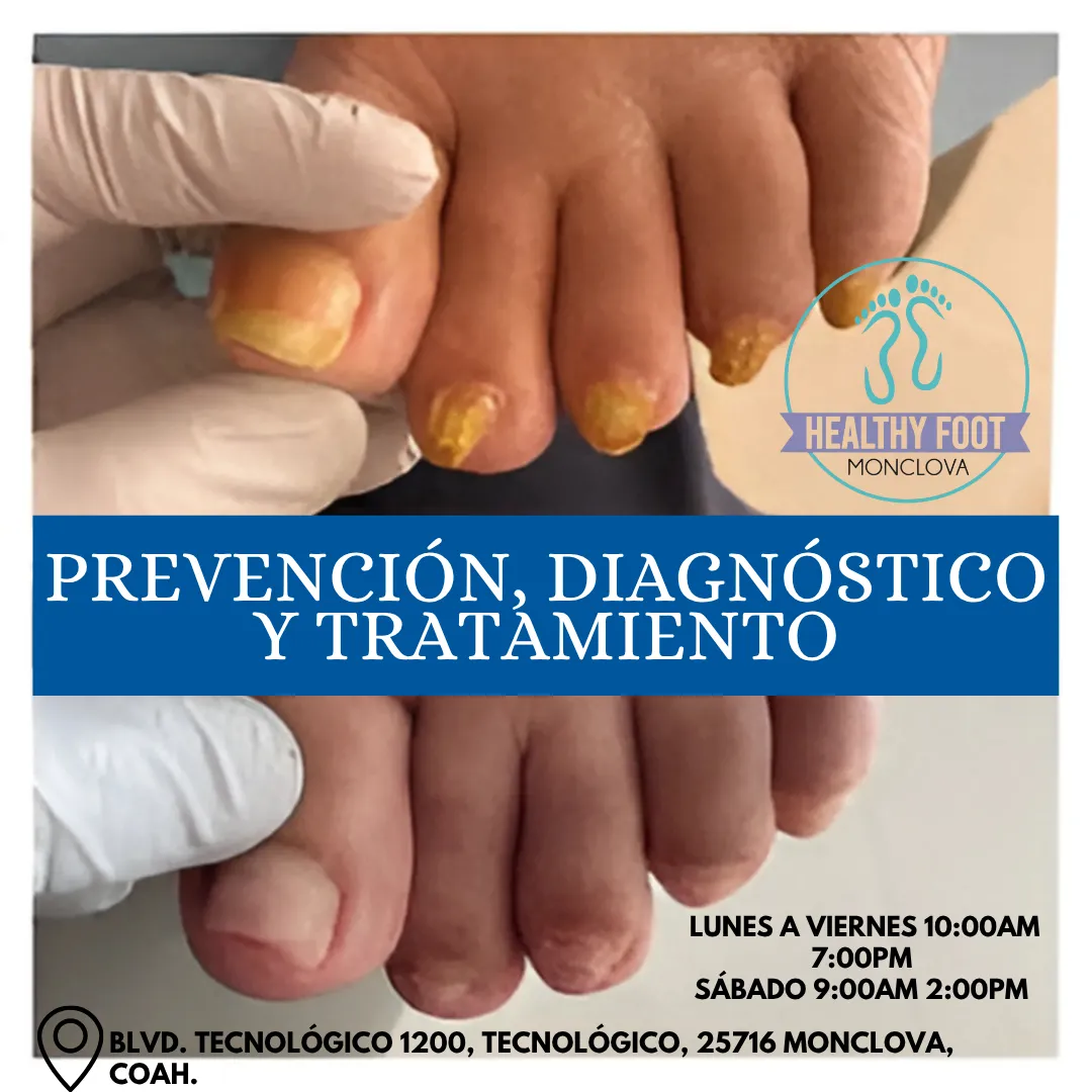 Diseño 134
