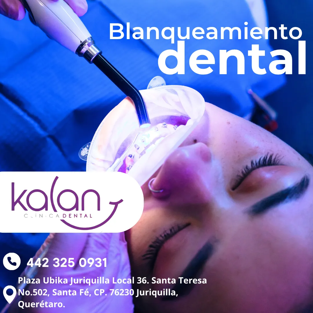 Diseño 22
