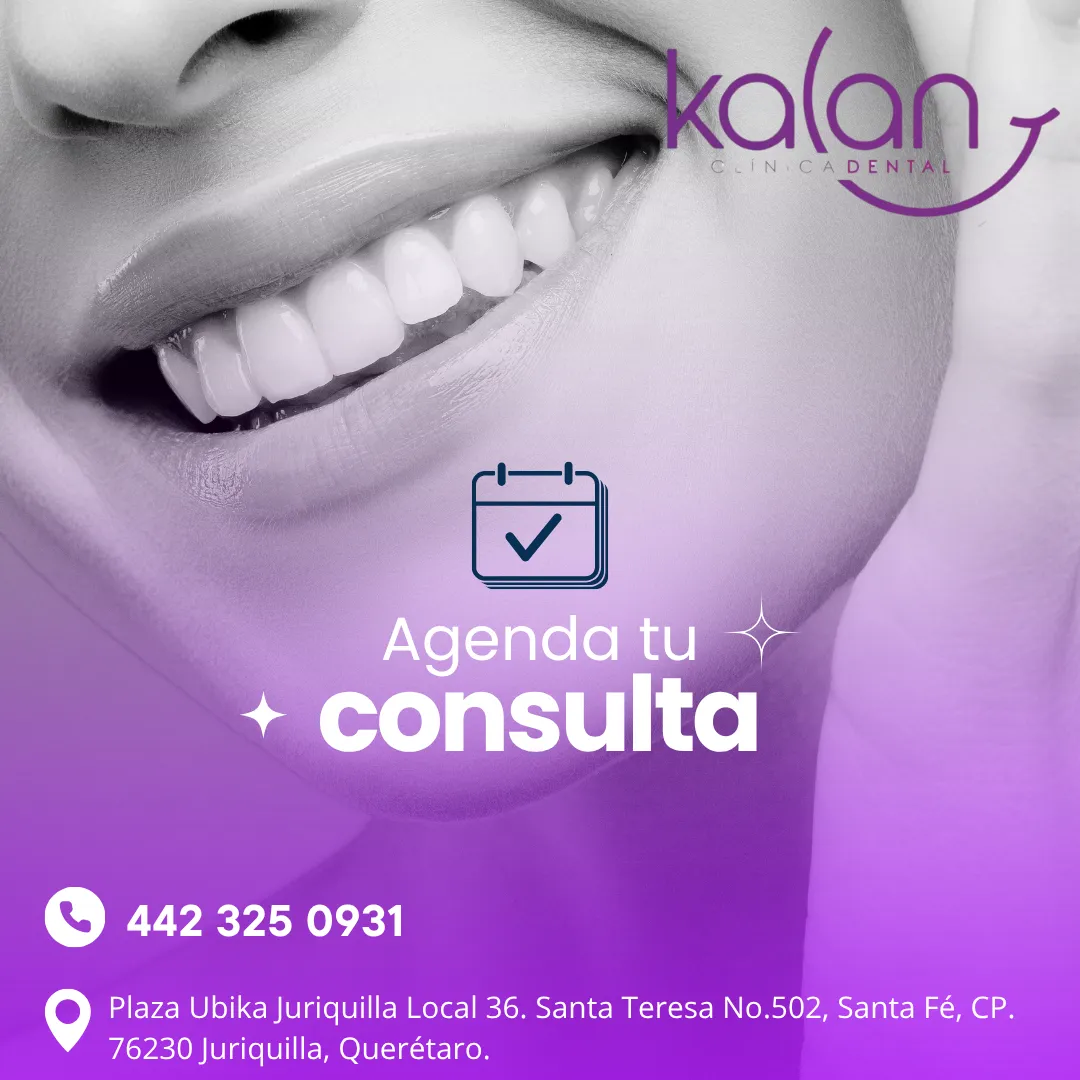 Diseño 54