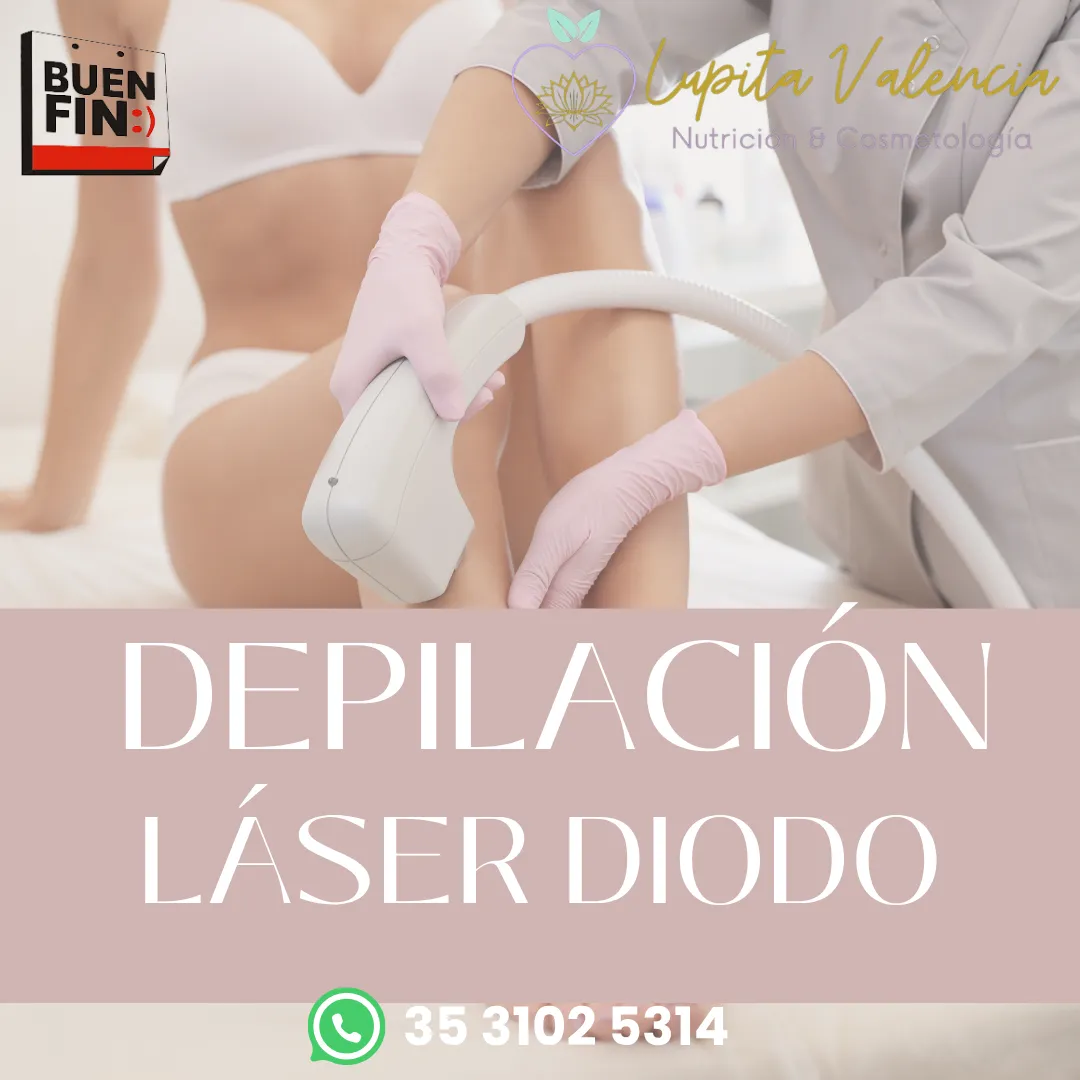 Diseño 75