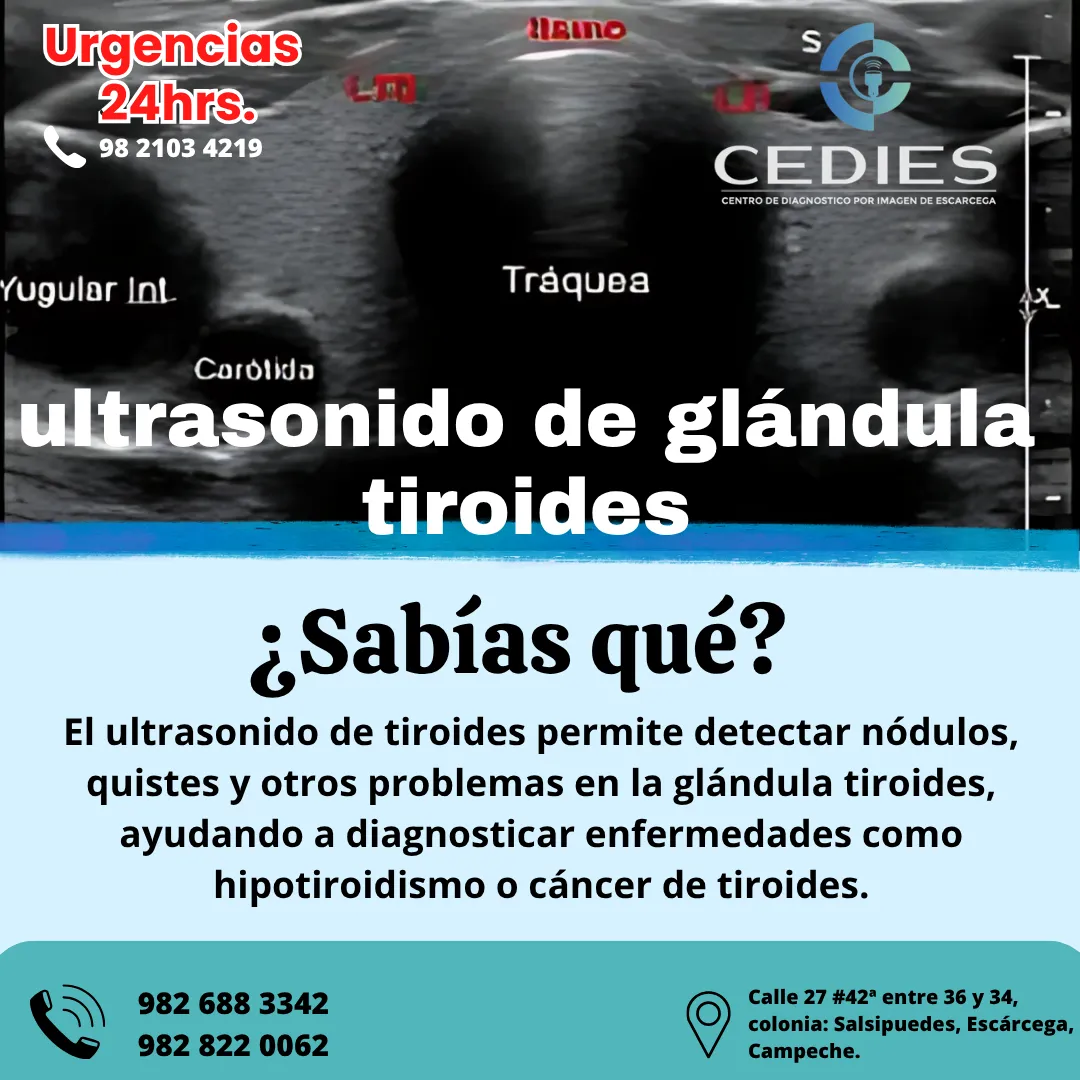 Diseño 68