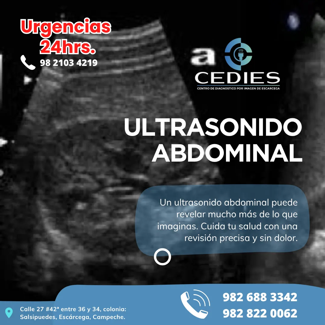 Diseño 27