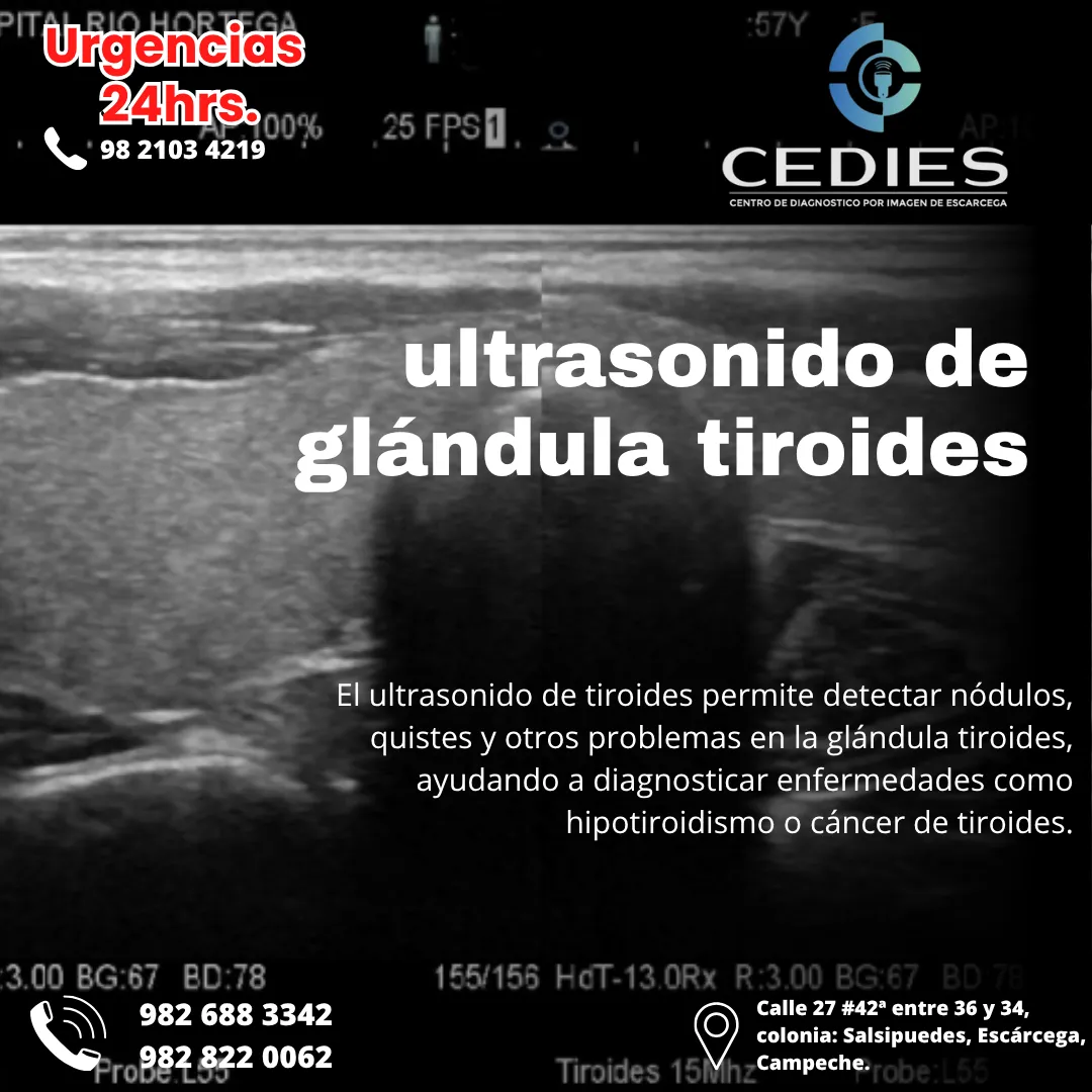 Diseño 61