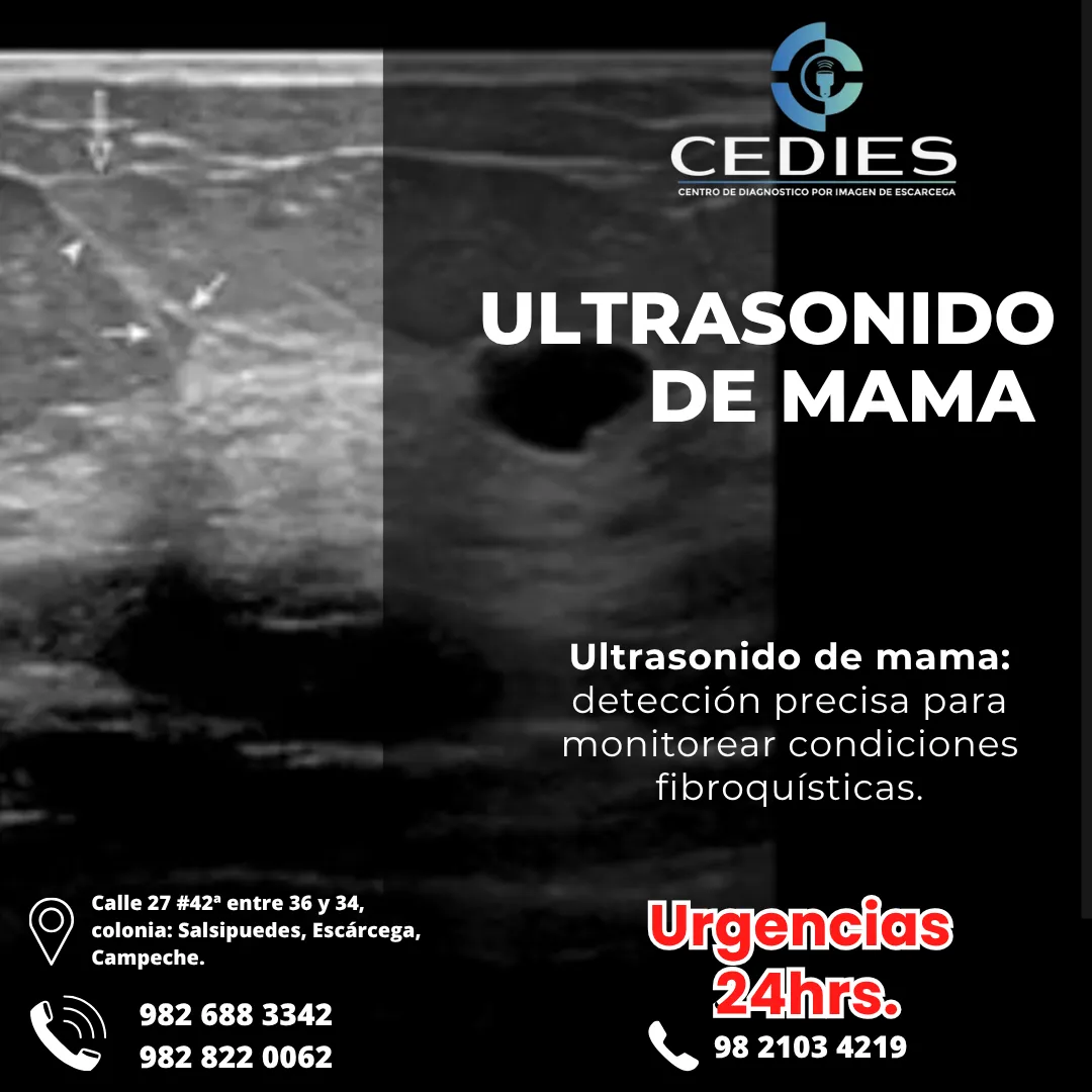 Diseño 23