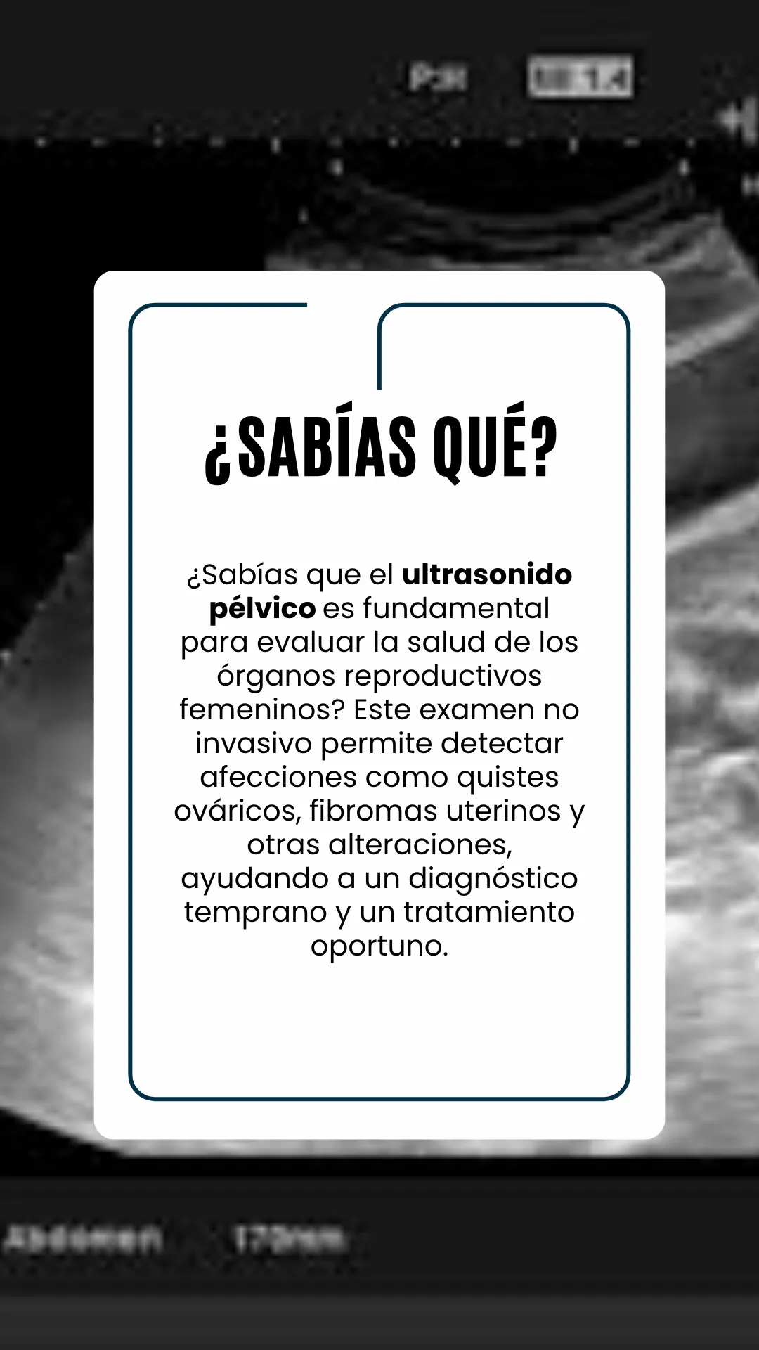Diseño 14