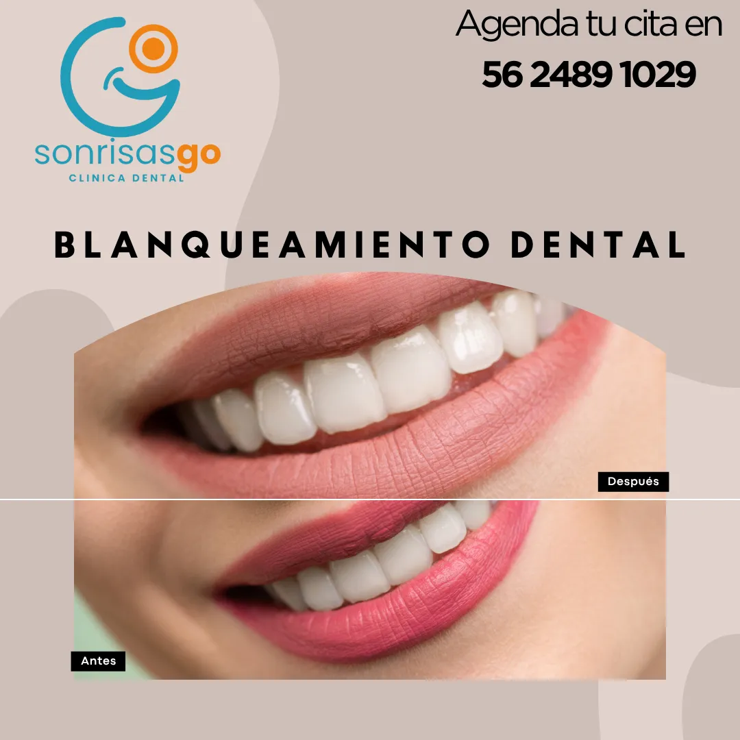 Diseño 127