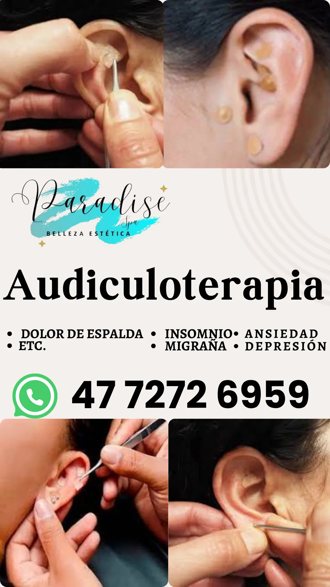 Diseño 34