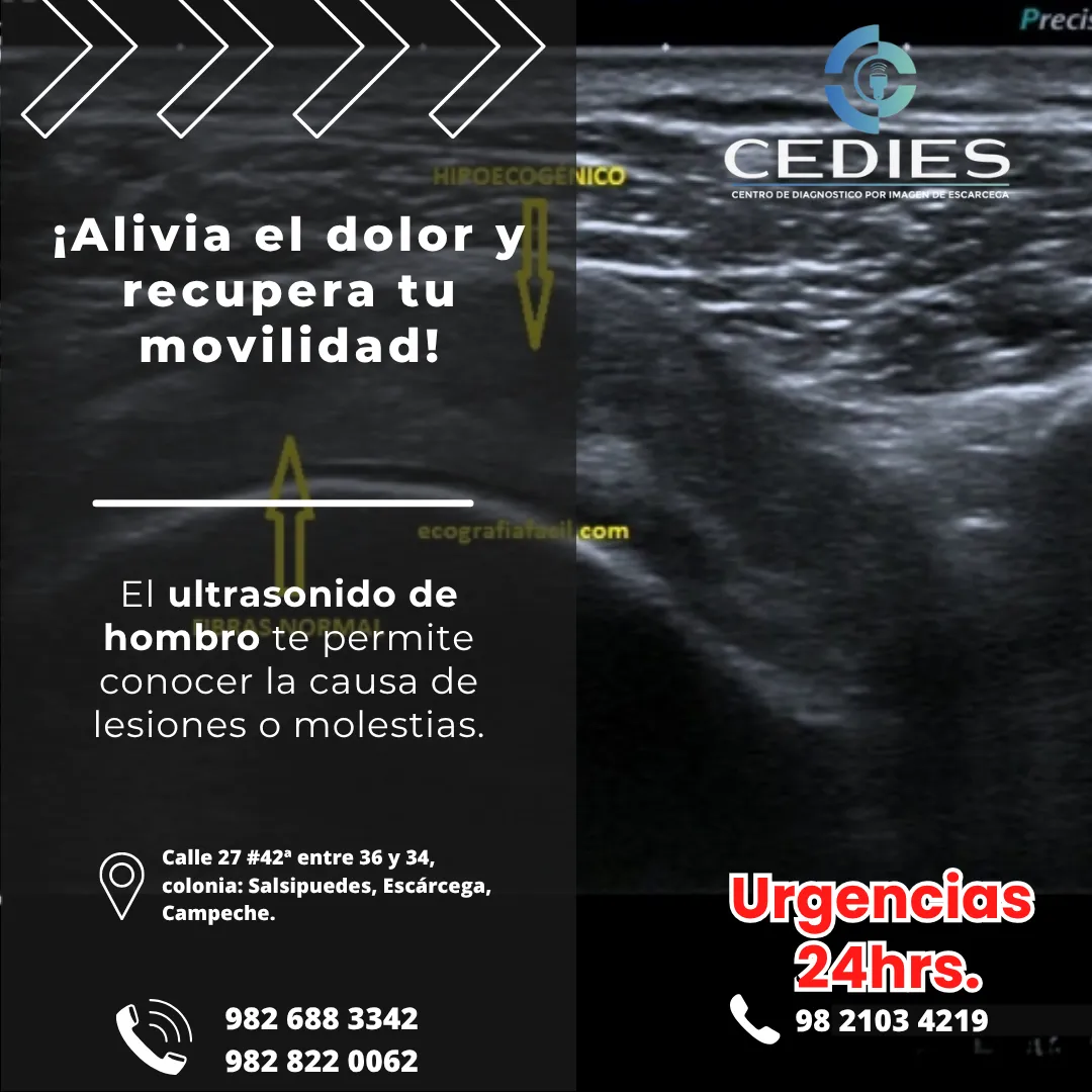 Diseño 17