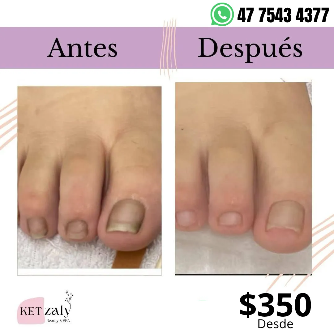 Diseño 70