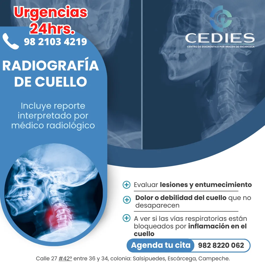 Cedies