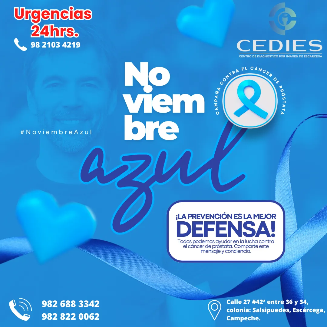 Diseño 58