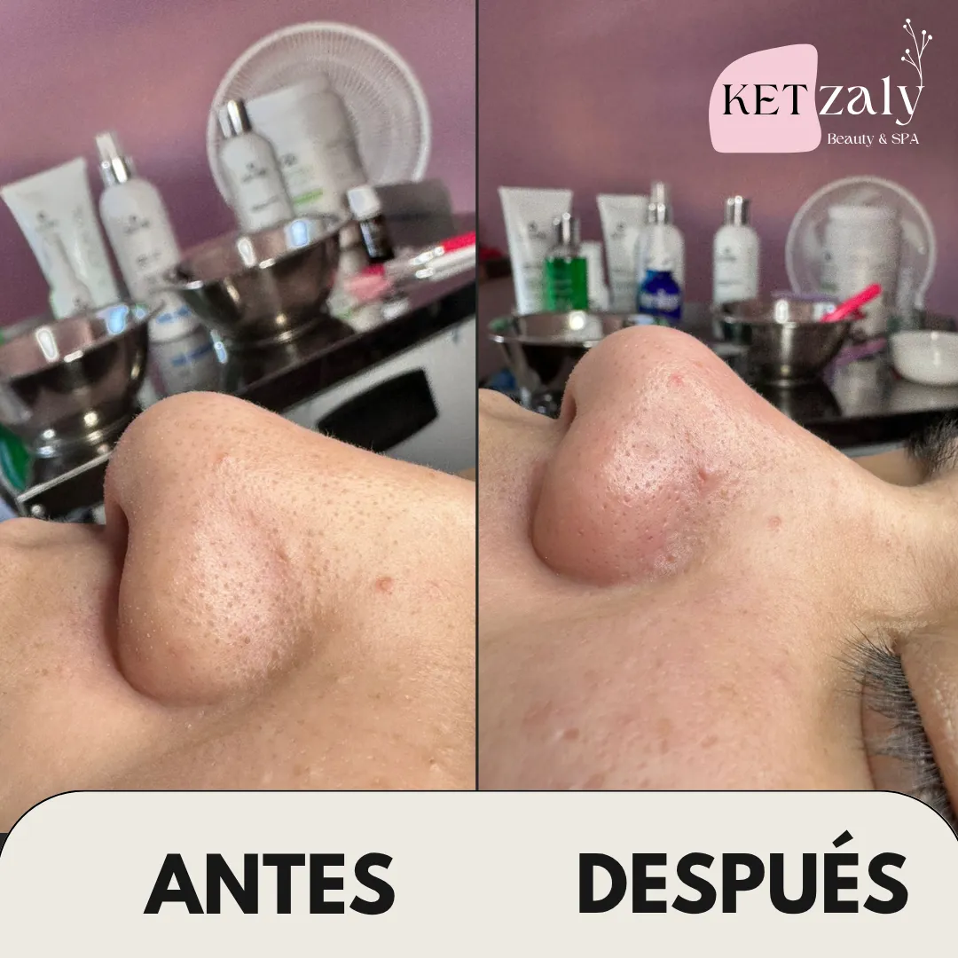 Diseño 12