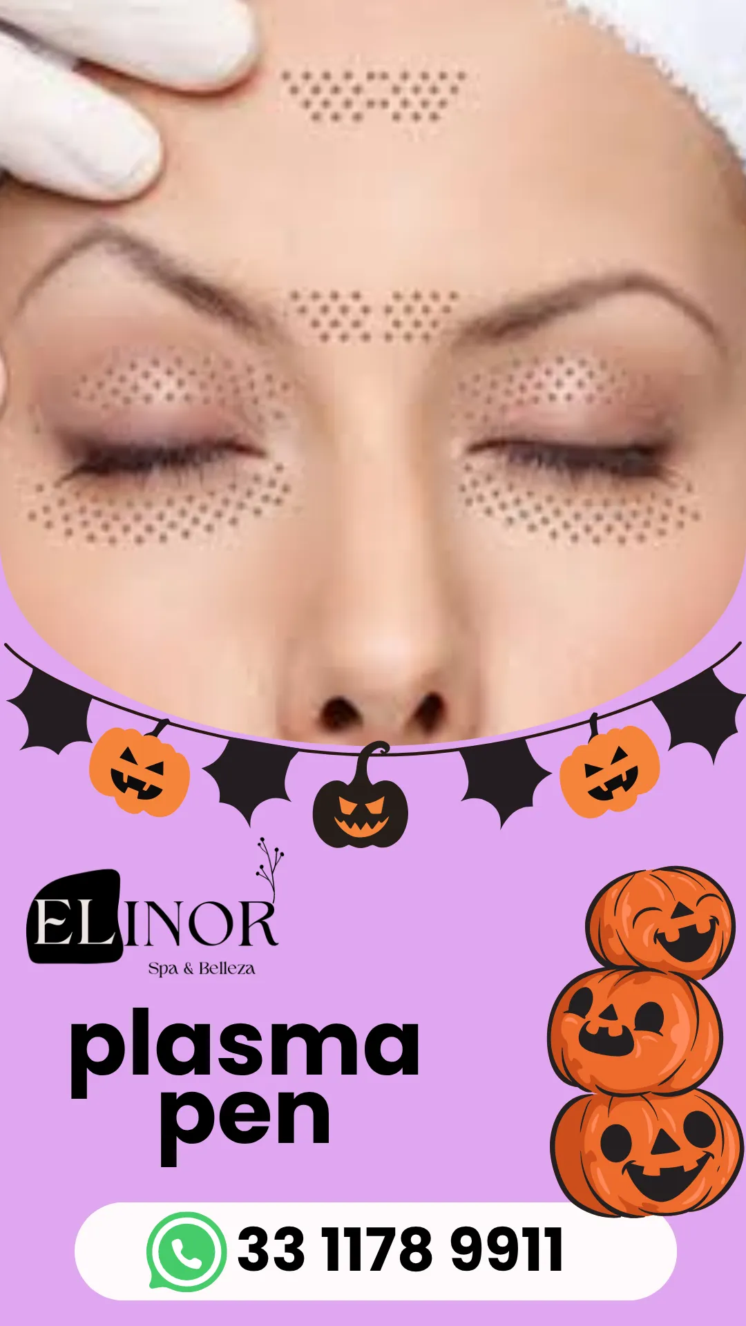 Diseño 3