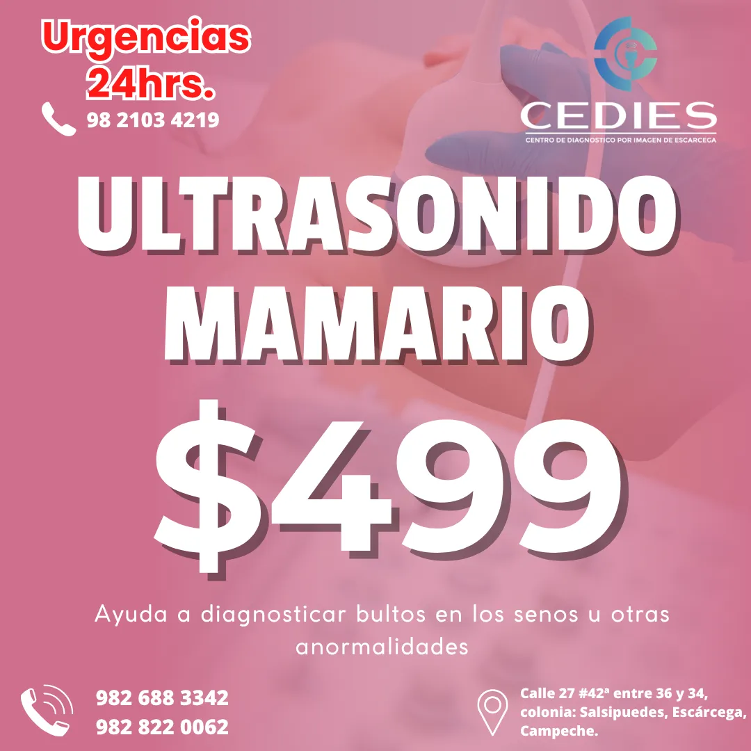 Diseño 39