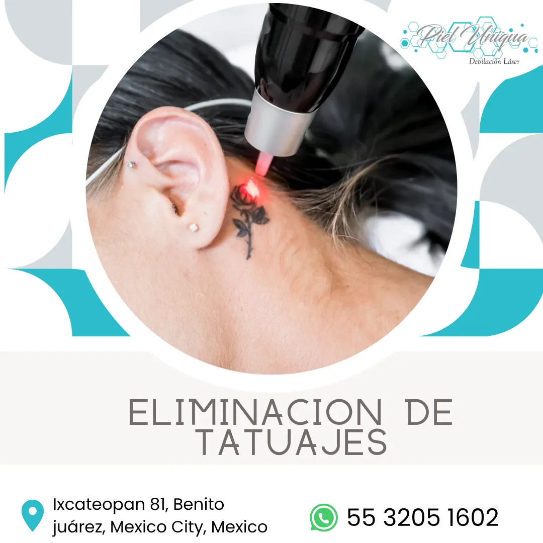 Diseño 22