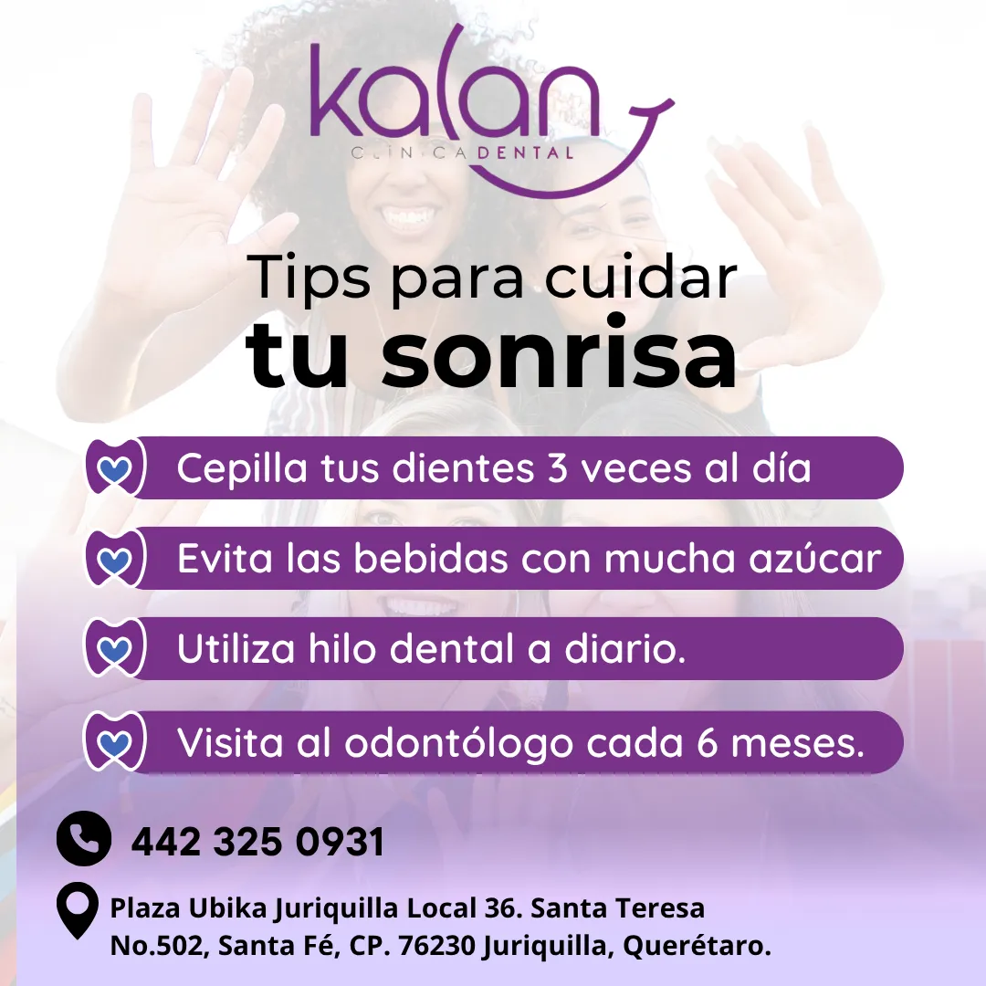 Diseño 87