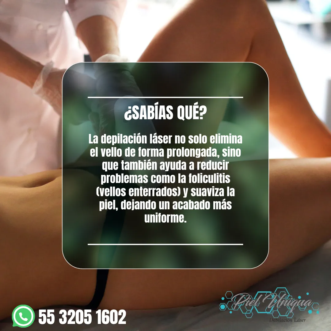 Diseño 38